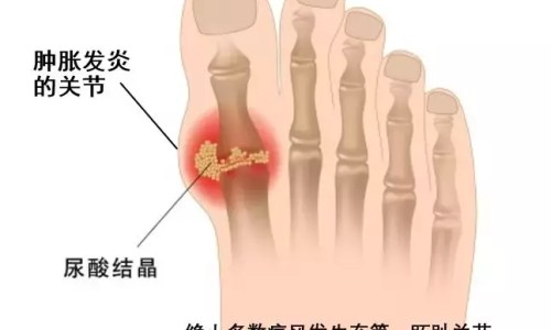 焦虑症病人为何容易发脾气-焦虑症病人都烦亲人吗、焦虑症病人家属该怎么做 -焦虑症病人适合的工作网